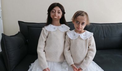 Progeria ile mücadele eden kardeşler hayata umutlu bakıyor